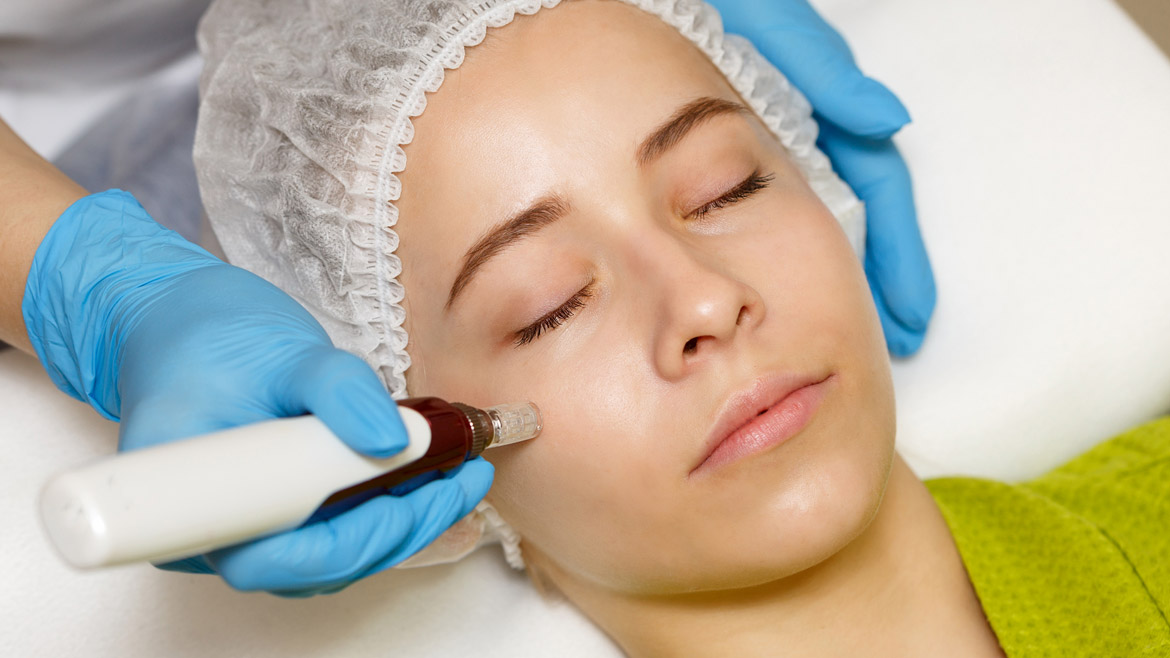 Después de Microagujas Dermapen