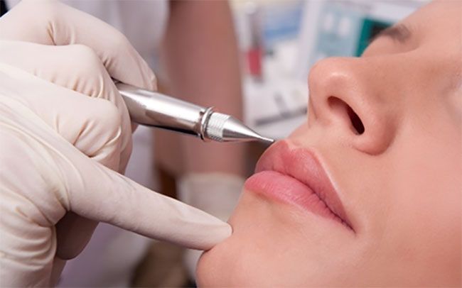Antes de la micropigmentación de labios