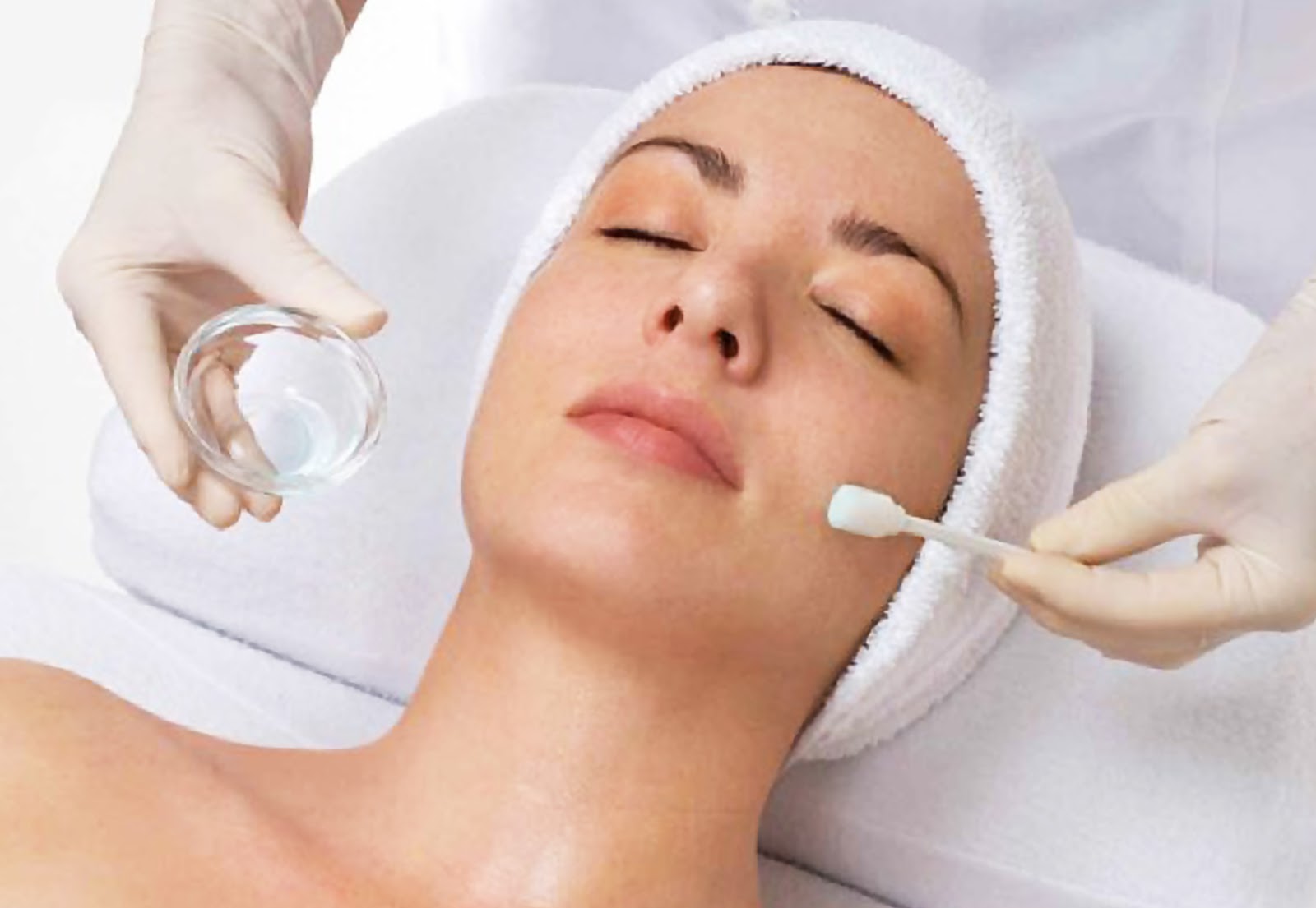 Después del peeling dermatológico