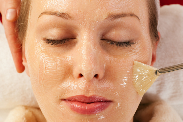 Antes del peeling dermatológico