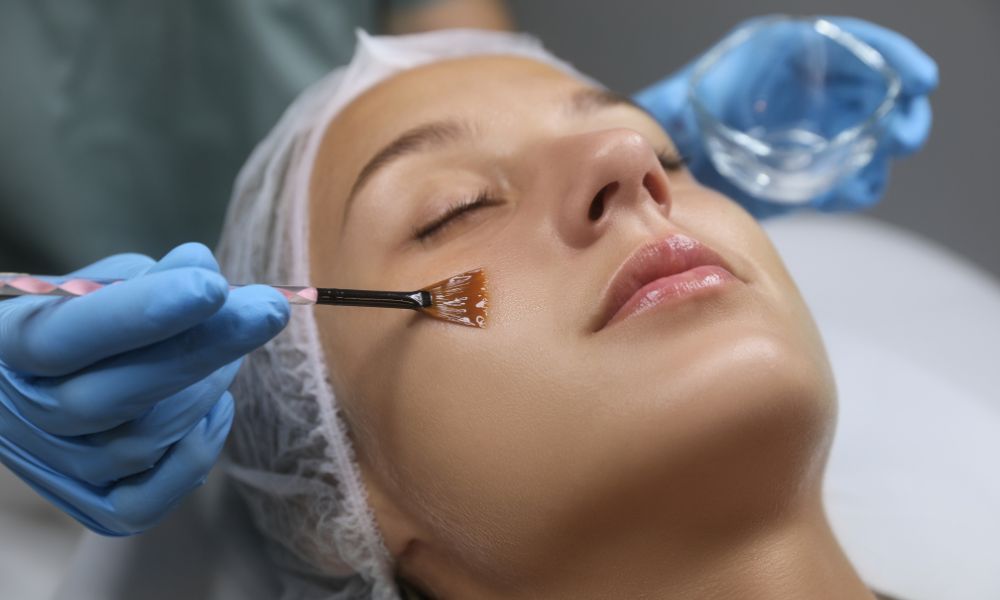 Peeling Dermatológico en Cali - Renovación Celular