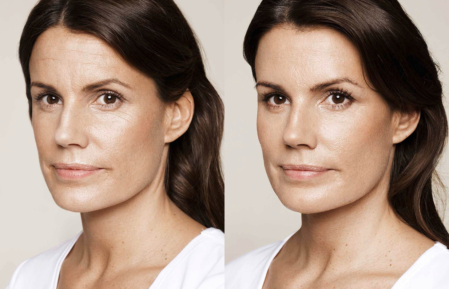 Después de la revitalización facial